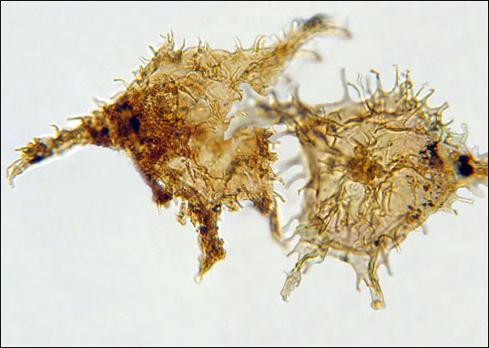Zdjęcie mikroskopowe: skamieniałe bruzdnice z okresu PETM