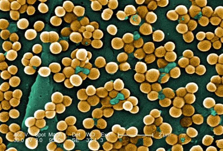 Gronkowiec złocisty (Staphylococcus aureus), zdjęcie mikroskopowe