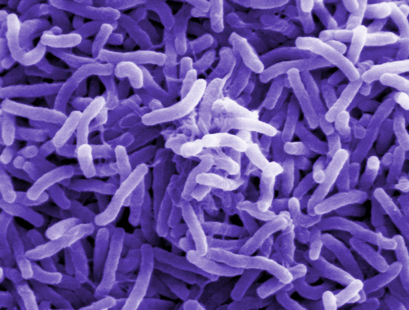 Przecinkowiec cholery - obraz mikroskopowy